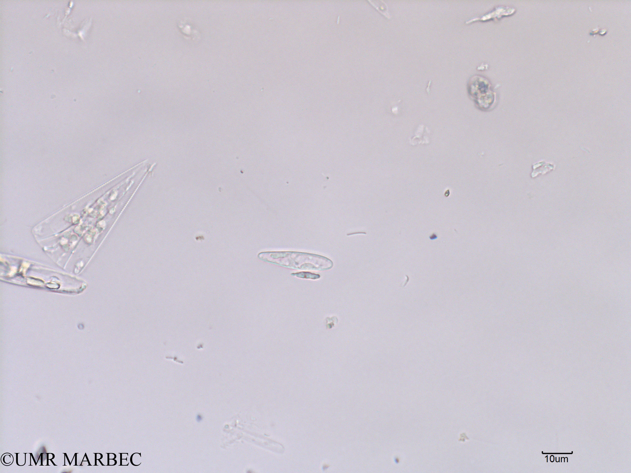 phyto/Scattered_Islands/iles_glorieuses/SIREME May 2016/Gomphonema sp2 (old Pennée spp 3-5x15-40µm -SIREME-Glorieuses2016-GLO5surf-191016-indeter3-1)(copy).jpg